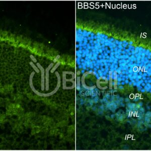 BBS5 antibody labeling of mouse retina