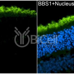 BBS1 antibody labeling of mouse retina