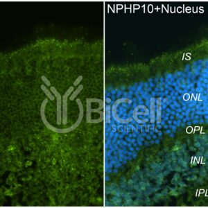 Anti-Nephrocystin-10 (NPHP10 or SDCCAG8 or BBS16) antibody labeling of retina