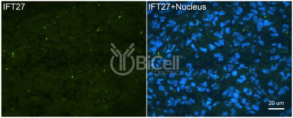Anti-IFT27 (BBS19) antibody labeling of embryonic skeletal muscle
