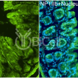 Anti-NPT2b (SLC34a2) antibody labeling of colon