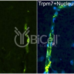 Trpm7 antibody labeling of mouse cerebral vasculature