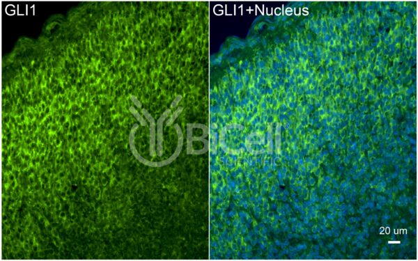 GLI1 antibody labeling of embryonic mouse brain