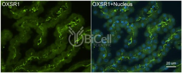 OXSR1 (OSR1) antibody labeling of choroid plexus