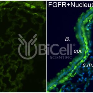 FGFR1 (FLT2 or CD331) antibody labeling of mouse lung