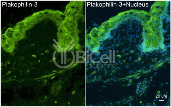 Plakophilin-3 (PKP3) antibody labeling of embryonic mouse skin