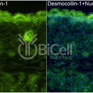 Desmocollin-1 (DSC1) antibody labeling of embryonic mouse skin