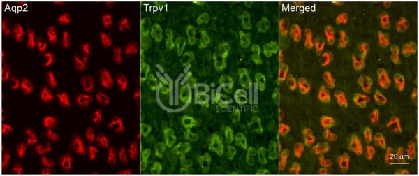Trpv1 antibody labeling of mouse kidney