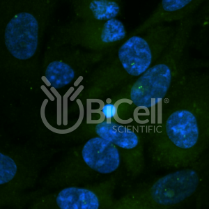 Centrin-2 antibody labeling of human RPE1 cells