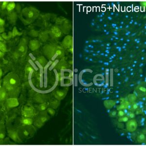 Trpm5 antibody labeling of dorsal root ganglion