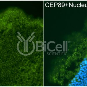 CEP89 (CCDC123) antibody labeling of mouse retina