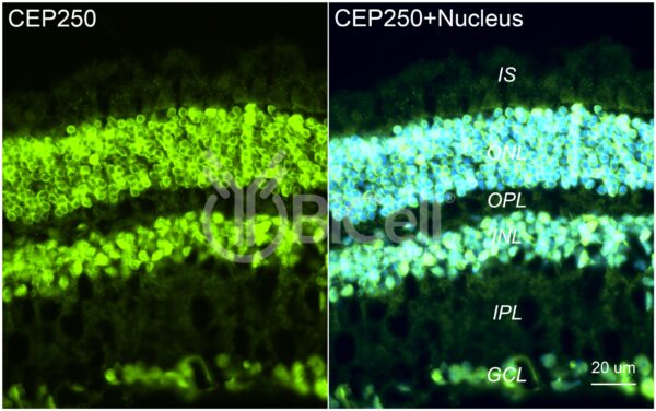 CEP250 antibody labeling of mouse retina