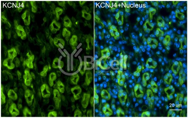 KCNJ4 (Kir2.3) antibody labeling of mouse kidney