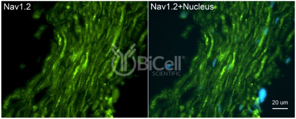 SCN2A (Nav1.2) antibody labeling of mouse spinal nerve