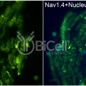SCN4A (Nav1.4) antibody labeling of mouse spinal nerve