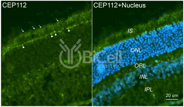 CEP112 (CCDC46) antibody labeling of mouse retina