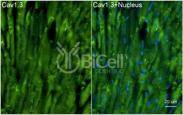 CACNA1D (Cav1.3) antibody labeling of mouse heart