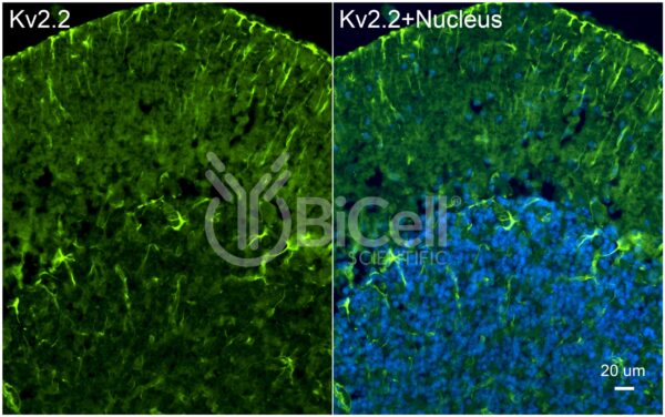KCNB2 (Kv2.2) antibody labeling of mouse cerebellum