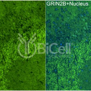 GRIN2B (GluN2B) antibody labeling of mouse cerebrum
