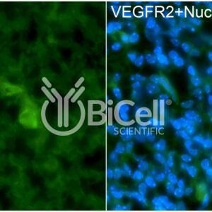 VEGFR2 (KDR or FLK1 or CD309) antibody labeling of embryonic mouse brain