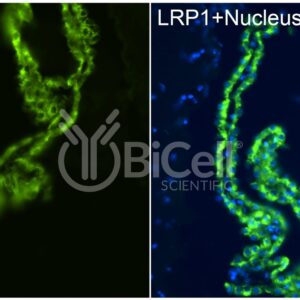 LRP1 antibody labeling of mouse choroid plexus