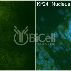 KIF24 antibody labeling of embryonic mouse kidney