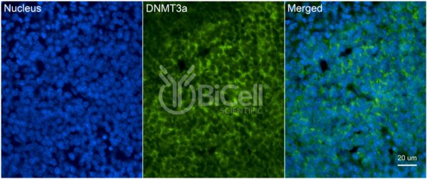 DNMT3A antibody labeling of embryonic mouse brain