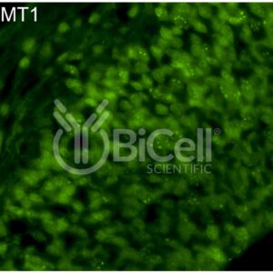 DNMT1 (DNMT) antibody labeling of embryonic mouse brain