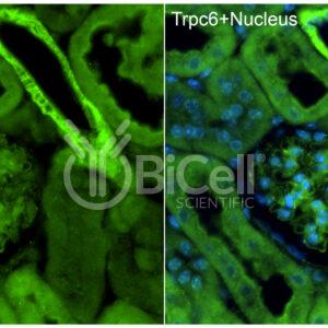 Trpc6 (N-terminus) antibody labeling of mouse kidney