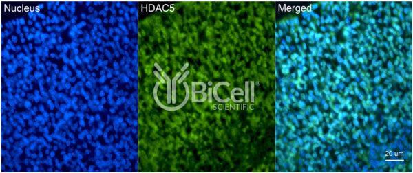 HDAC5 antibody labeling of embryonic mouse brain