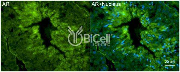 AR (NR3C4) antibody labeling of mouse testis