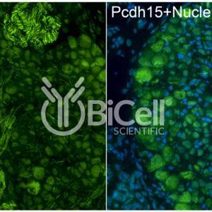 Protocadherin-15 (PCDH15) antibody labeling of embryonic mouse ganglion