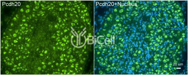 Protocadherin-20 (PCDH20 or PCDH13) antibody labeling of embryonic mouse ganglion