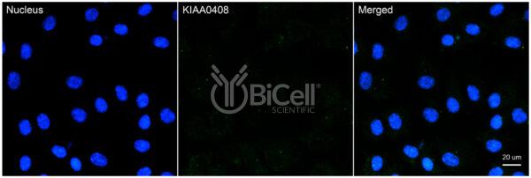 KIAA0408 (N-terminus) antibody labeling of human RPE-1 cells