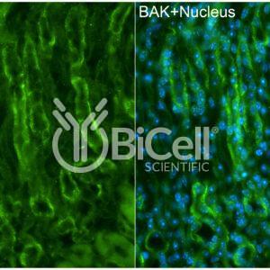 BAK (BAK1 or BCL2L7) antibody labeling of mouse kidney