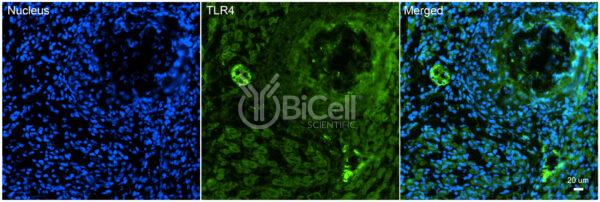 Toll-like receptor 4 (TLR4 or CD284) antibody labeling of embryonic mouse lymph nodes