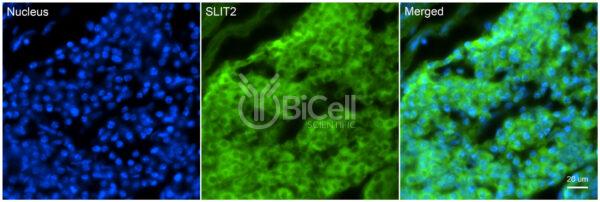 SLIT2 antibody labeling of embryonic mouse dorsal root ganglion