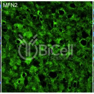 Mitofusin-2 (MFN2) antibody labeling of embryonic mouse dorsal root ganglion