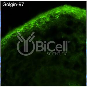 GOLGA1 (Golgin-97) antibody labeling of embryonic mouse skin