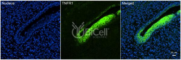 TNFRSF1A (TNFR1 or CD120a) antibody labeling of embryonic mouse skin