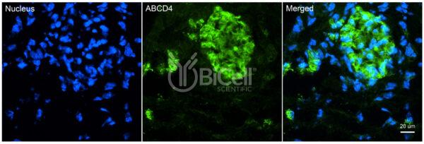 ABCD4 antibody labeling of embryonic mouse dorsal root ganglion