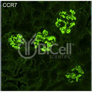 CCR7 (CD197) antibody labeling of mouse kidney