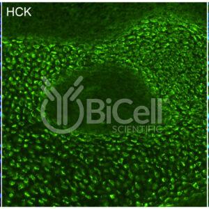 HCK antibody labeling of embryonic mouse bone