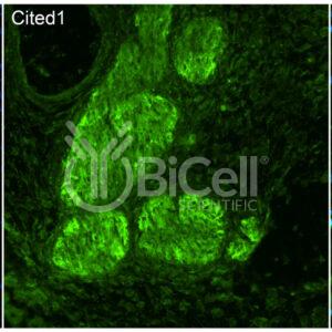 CITED1 antibody labeling of embryonic mouse dorsal root ganglion