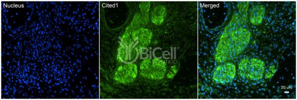 CITED1 antibody labeling of embryonic mouse dorsal root ganglion