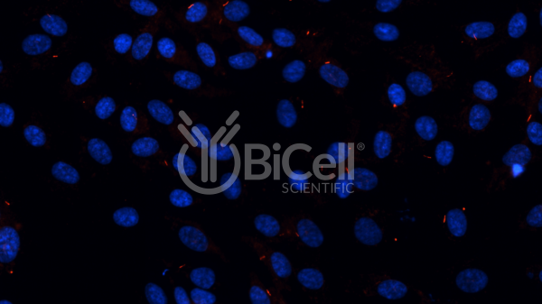 ARL13B (human) (ARL2L1) HiRe (rabbit) antibody validation in human RPE1 cells