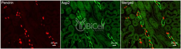 Aquaporin-2 (AQP2) antibody labeling of mouse kidney