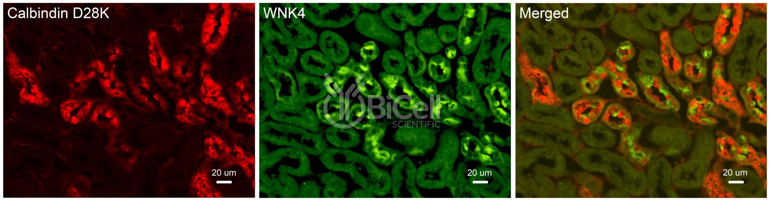 WNK4 antibody - BiCell Scientific®