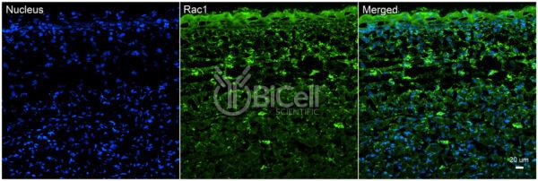 RAC1 antibody labeling of embryonic mouse skin